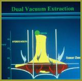 extractiondiagram
